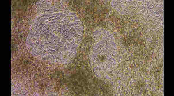 研究稱受歡迎口味電子煙煙油中的香精可能對心臟有害 